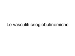 Le vasculiti crioglobulinemiche