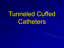 Tunneled Cuffed Catheters