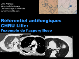 Référentiel antifongiques CHRU Lille: l’exemple de l’aspergillose Dr S. Alfandari