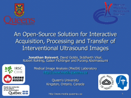 An Open-Source Solution for Interactive Acquisition, Processing and Transfer of