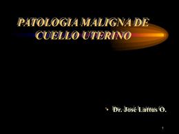 PATOLOGIA MALIGNA DE CUELLO UTERINO • Dr. José Lattus O.
