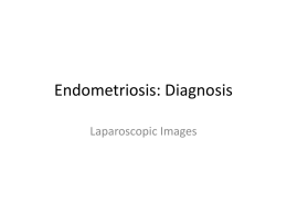Endometriosis: Diagnosis Laparoscopic Images