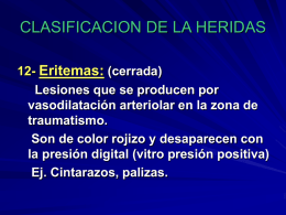 CLASIFICACION DE LA HERIDAS Eritemas:
