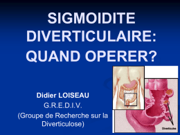 SIGMOIDITE DIVERTICULAIRE: QUAND OPERER? Didier LOISEAU