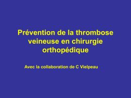 Prévention de la thrombose veineuse en chirurgie orthopédique