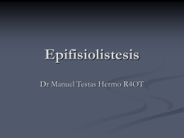 Epifisiolistesis Dr Manuel Testas Hermo R4OT