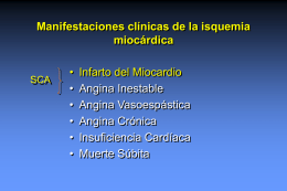 Manifestaciones clínicas de la isquemia miocárdica • Infarto del Miocardio • Angina Inestable