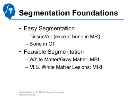 Segmentation Foundations • Easy Segmentation • Feasible Segmentation