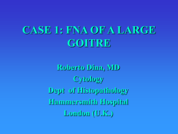 CASE 1: FNA OF A LARGE GOITRE Roberto Dina, MD Cytology
