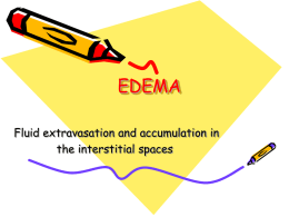 EDEMA Fluid extravasation and accumulation in the interstitial spaces