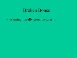 Broken Bones • Warning…really gross pictures…
