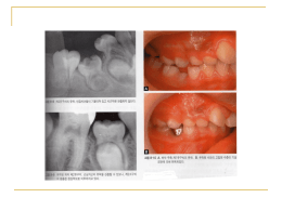 치아의 형성