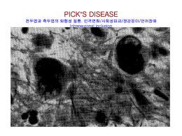 PICK`S DISEASE 전두엽과 측두엽의 퇴행성 질환. 인격변화/사회성