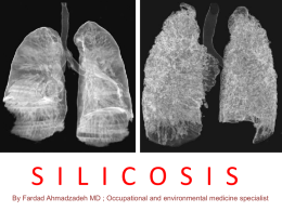 SILICOSIS.ppt