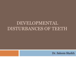 devlopmental anamolies of teeth 2