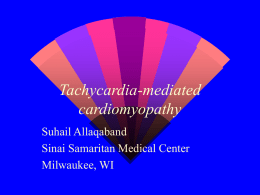 Suhail Allaqaband. Аритмогенная кардиомиопатия