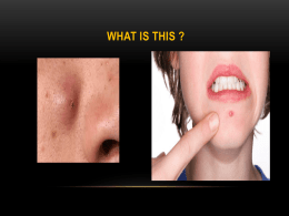 Lecture 7- Acne and Acniform Eruptions.ppt