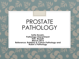 2-Prostate Pathology, Sufia Husain, March 2016.ppt