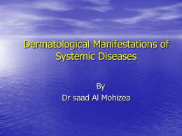 6-systemic diseases.ppt