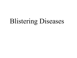 9-Blistering Diseases.ppt