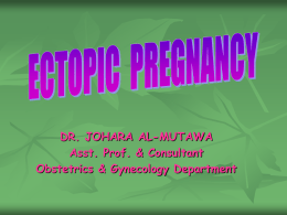 10. ectopic pregnancy.ppt