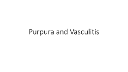 9-Purpura and Vasculitis_Dr. Haddab(1).pptx