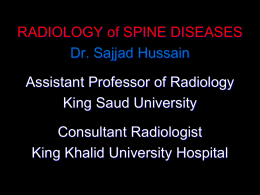Lecture 10-Radiology of the Spinal Diseases.pptx