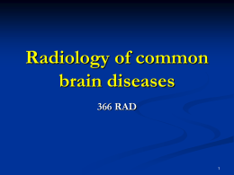 Lecture 8-Radiology of Common Brain Diseases.ppt