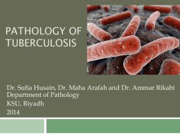 L4-Tuberculosis Sufia 2014.ppt