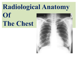 L5- X-ray chest.ppt