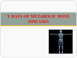 Metabolic ds Xray [PPT]