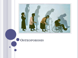 Osteoporosis PE [PPT]