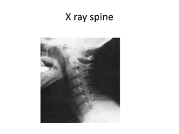 X RAY SPINE [PPT]