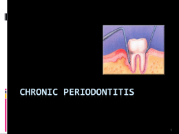 Chronic Periodontitis [PPT]