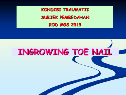2.2.2 - ingrowing toenail 1