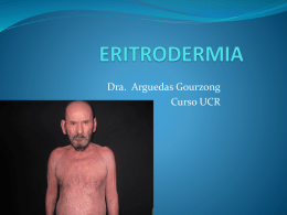 Eritrodermia PPT