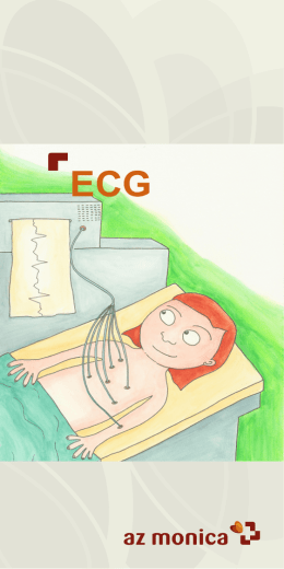 ECG-onderzoek