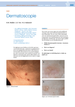 Dermatoscopie