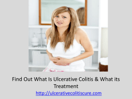 Get Best Knowledge about Ulcerative Colitis and Treatment