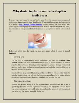 Why dental implants are the best option tooth issues